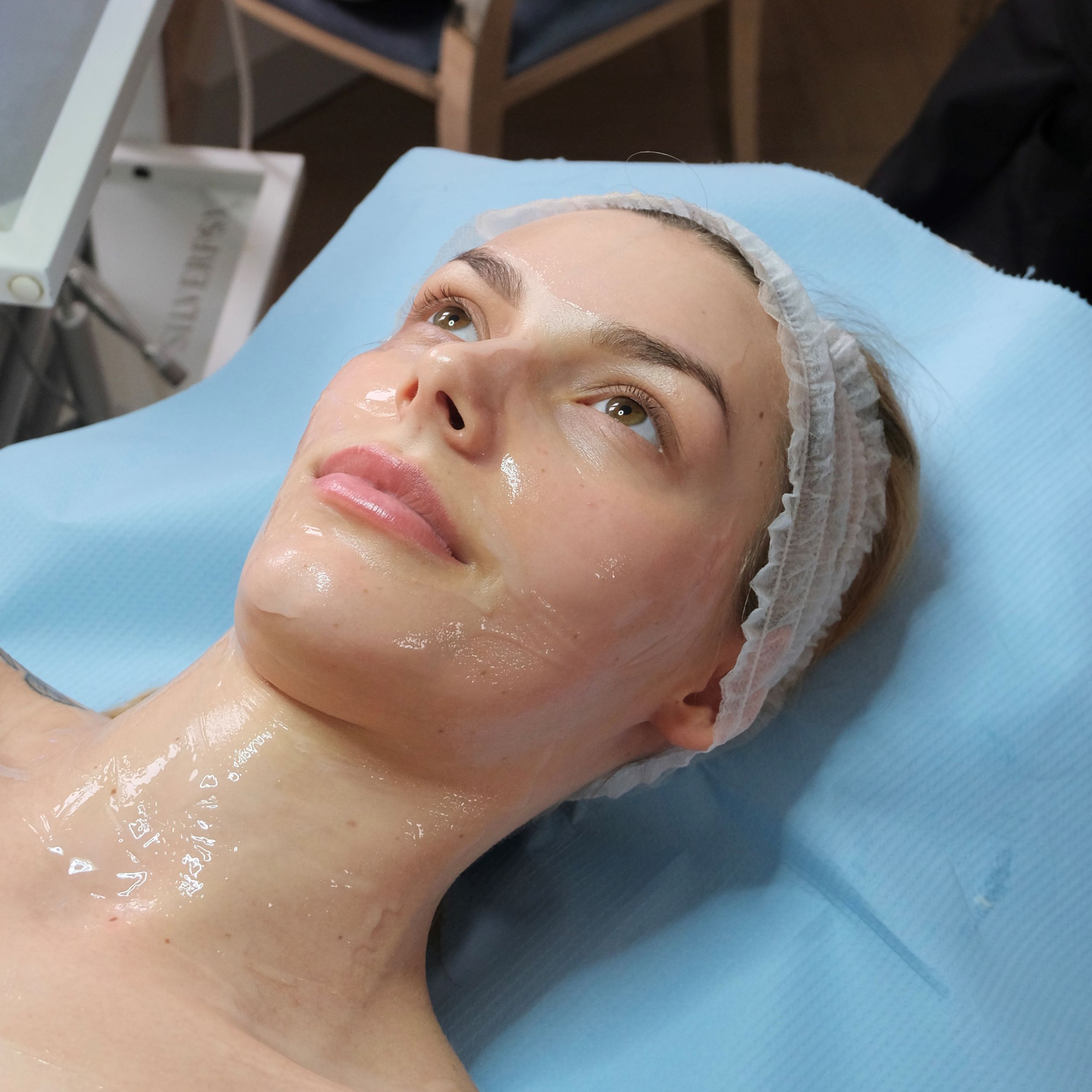 peeling chemiczny Gizińscy